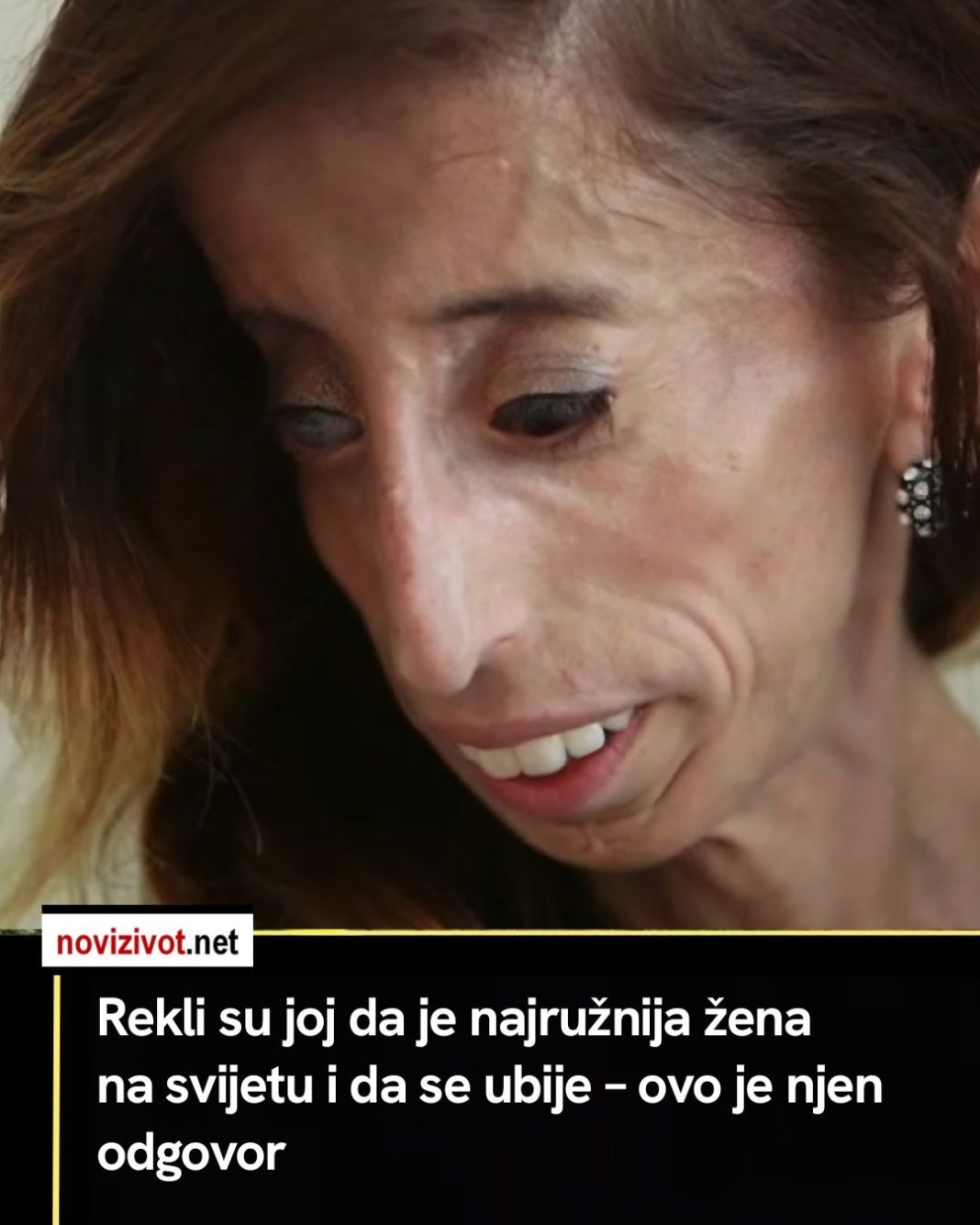 Rekli su joj da je najružnija žena na svijetu i da se ubije – ovo je njen odgovor - featured image