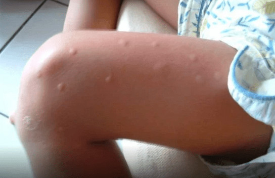KOMARCI VAM PRAVE PAKAO OD ŽIVOTA? Samo isijecite OVO VOĆE na pola i ostavite u sobi, VIŠE IH NIKADA NEĆETE VIDJETI BLIZU! KOMARCI VAM PRAVE PAKAO OD ŽIVOTA? Samo isijecite OVO VOĆE na pola i ostavite u sobi, VIŠE IH NIKADA NEĆETE VIDJETI BLIZU! - featured image
