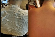 Izgorjela je na suncu, a ovaj 1 trik njene majke ju je spasio:Riječ je o proizvodu koji svi imamo… Izgorjela je na suncu, a ovaj 1 trik njene majke ju je spasio:Riječ je o proizvodu koji svi imamo… - featured image