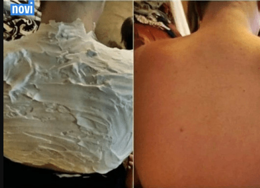 Izgorjela je na suncu, a ovaj 1 trik njene majke ju je spasio:Riječ je o proizvodu koji svi imamo… - featured image Izgorjela je na suncu, a ovaj 1 trik njene majke ju je spasio:Riječ je o proizvodu koji svi imamo… - featured image